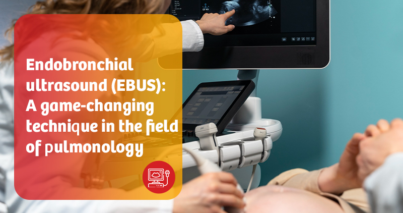 Endobronchial ultrasound 