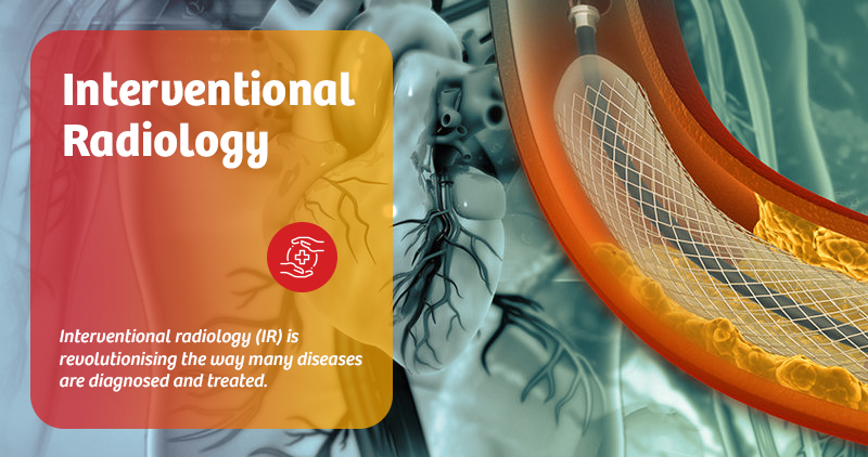 interventional-radiology