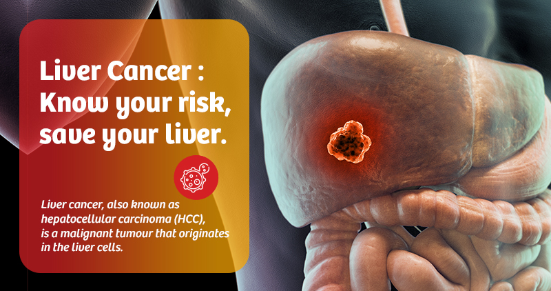 liver cancer know your risk save your liver