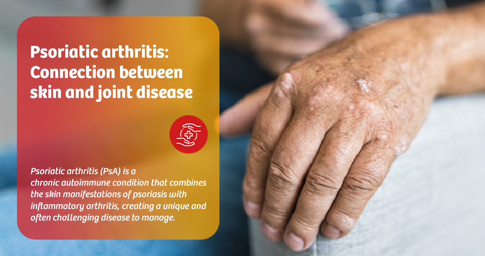 hepatic-encephalopathy