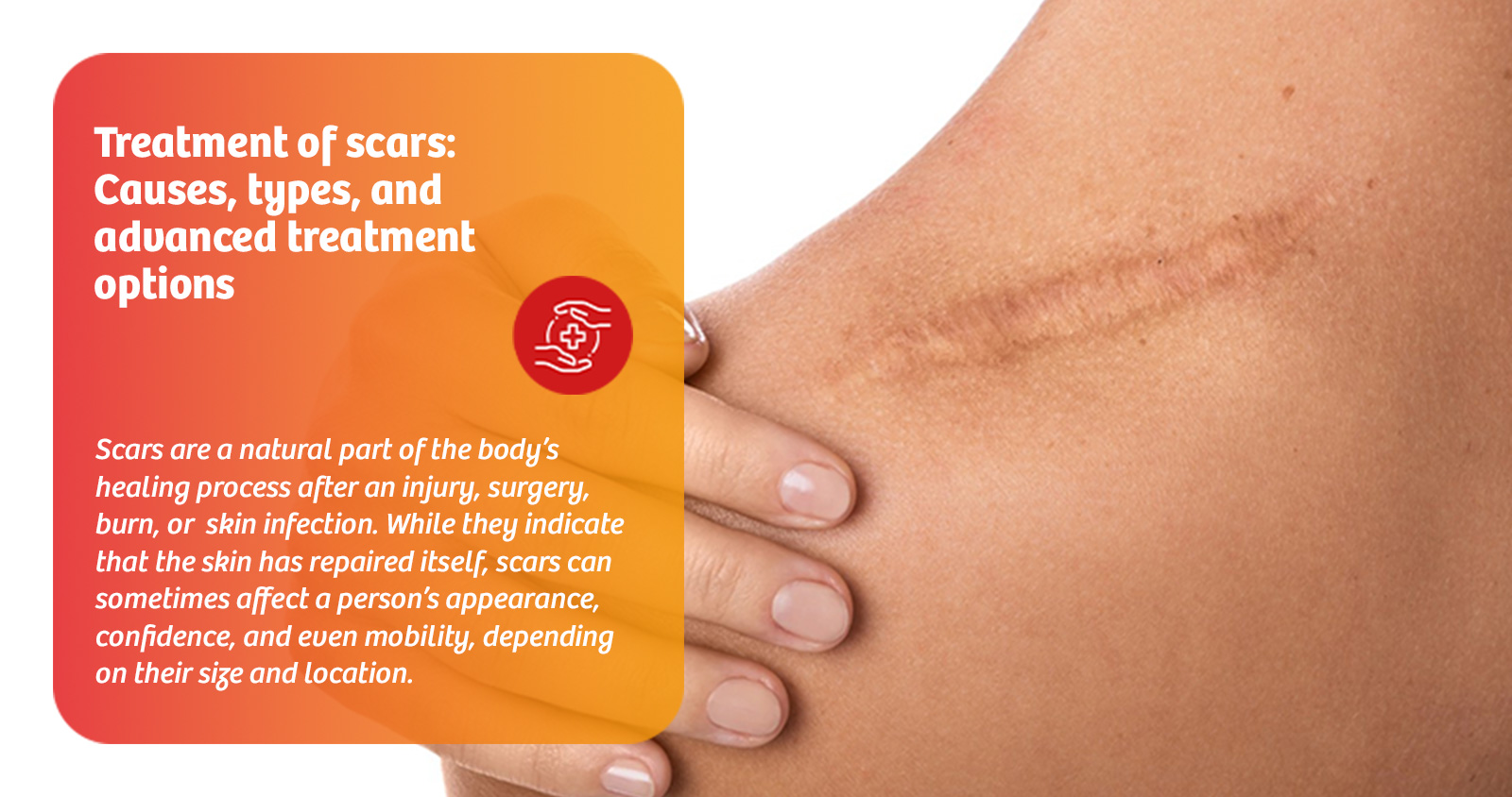 treatment-of-scars-causes-types-and-advanced-treatment-options